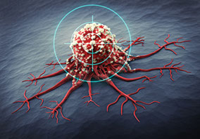 Ein Fadenkreuz zielt auf eine Krebszelle