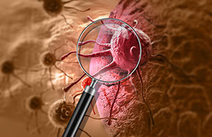 Eine Lupe vergroessert die Sicht auf eine Krebszelle
